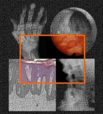 ��� ���������� ���� �������� ����������