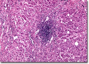 ��������� ����������� �� ������� B � C ��������� �� 9 ����