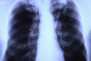 ���������� �������� �� ����������� � ���